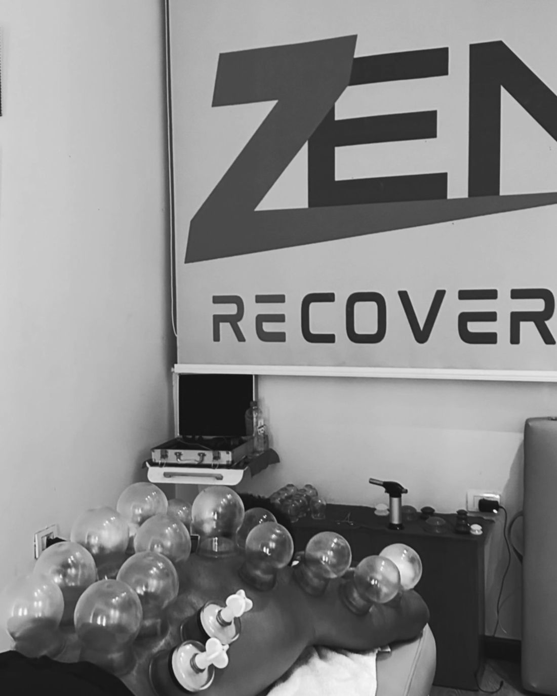 Glass cups along a client's back in the Zen Recovery studio