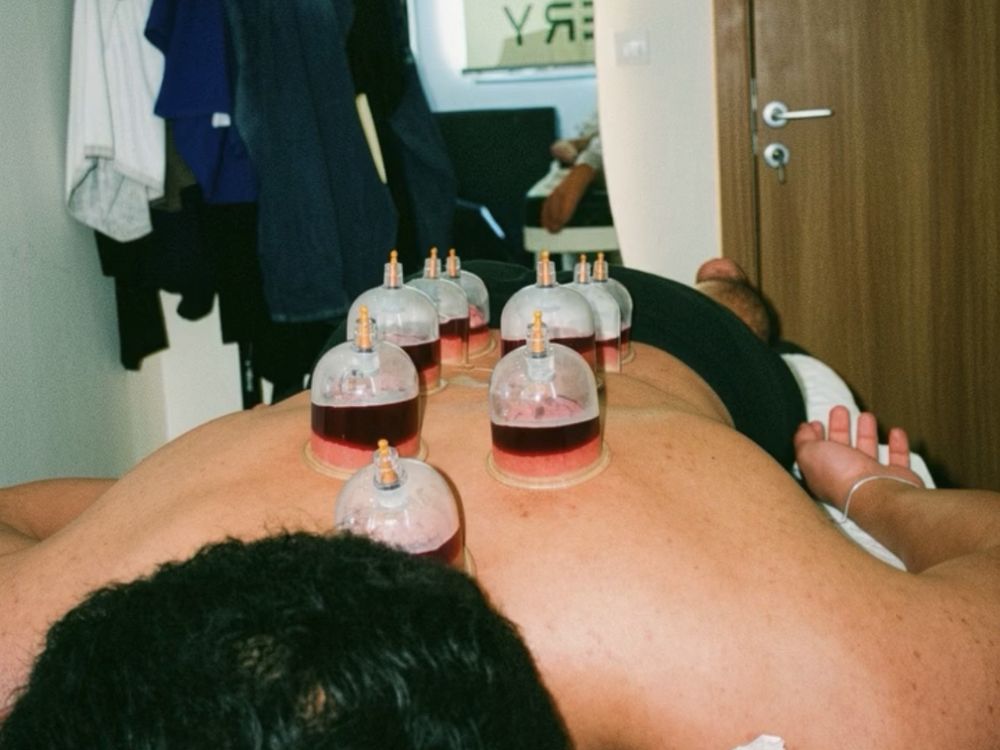 Hijama cups along the spine, the studio banner reflected in the mirror